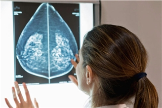 Die Überlebenschancen von Brustkrebs-Patientinnen und -Patienten haben sich dank neuer Entwicklungen und Fortschritten in der Therapie deutlich verbessert. Foto: djd/www.brustkrebs.de/Getty Images/andresr